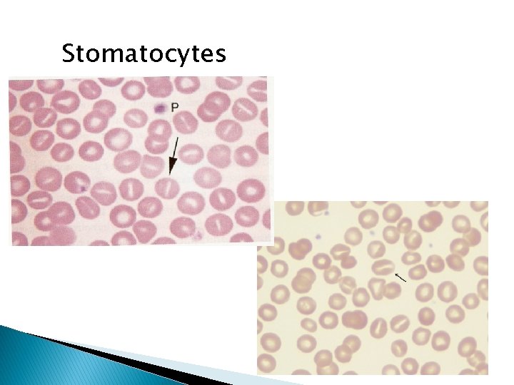 Stomatocytes 