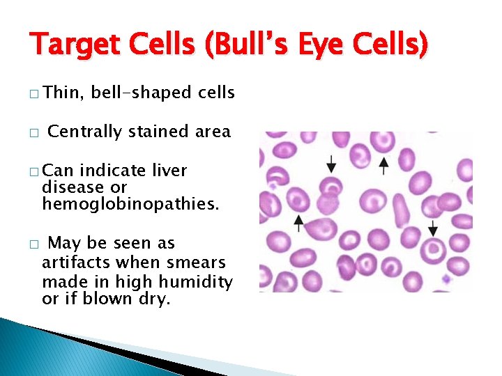 Target Cells (Bull’s Eye Cells) � Thin, � bell-shaped cells Centrally stained area �