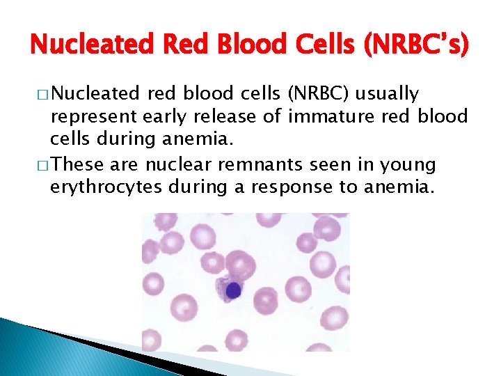 Nucleated Red Blood Cells (NRBC’s) � Nucleated red blood cells (NRBC) usually represent early
