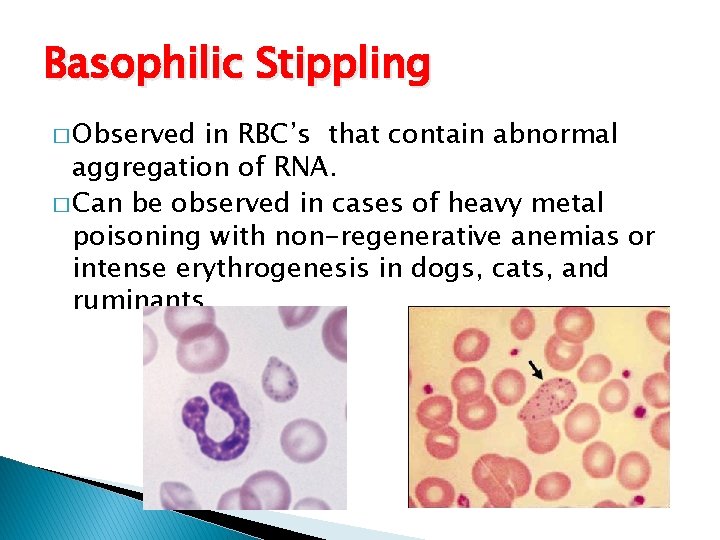 Basophilic Stippling � Observed in RBC’s that contain abnormal aggregation of RNA. � Can