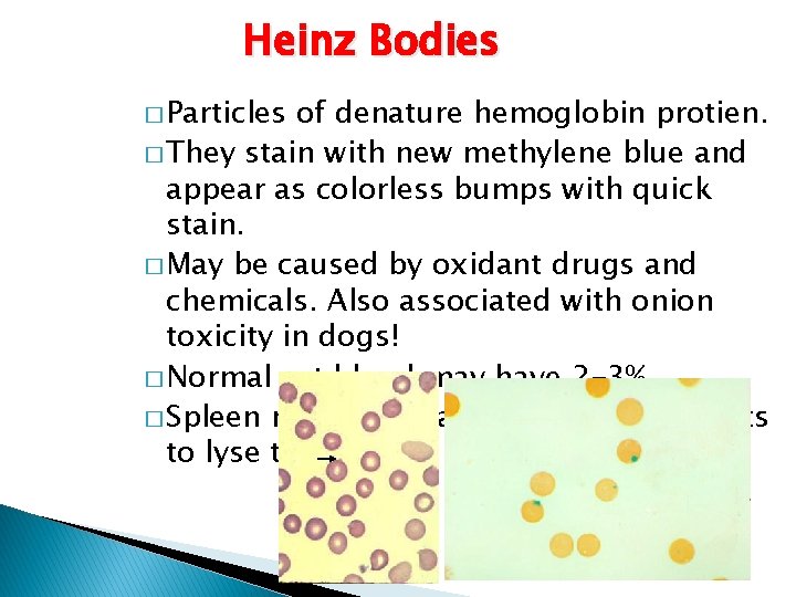 Heinz Bodies � Particles of denature hemoglobin protien. � They stain with new methylene