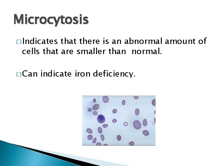 Microcytosis � Indicates that there is an abnormal amount of cells that are smaller
