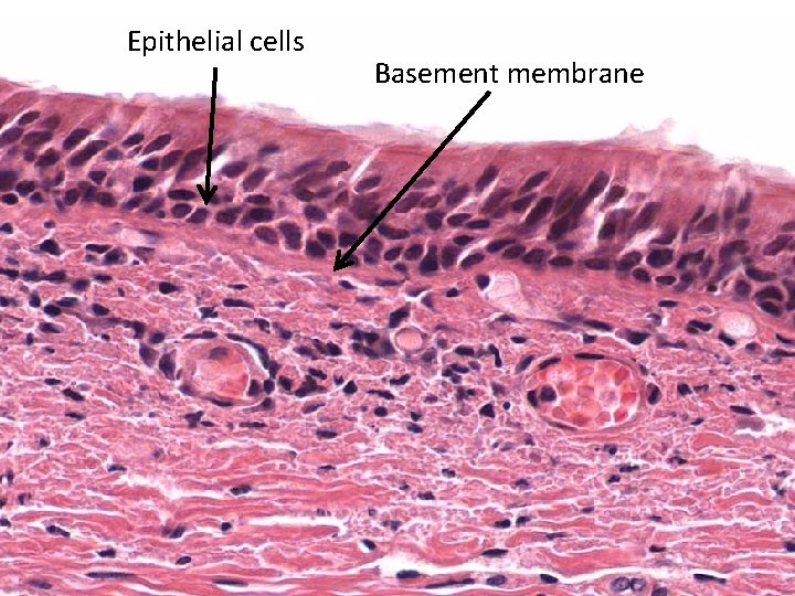 Epithelial cells Basement membrane 