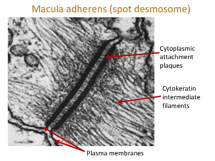 Macula adherens (spot desmosome) Cytoplasmic attachment plaques Cytokeratin intermediate filaments Plasma membranes 