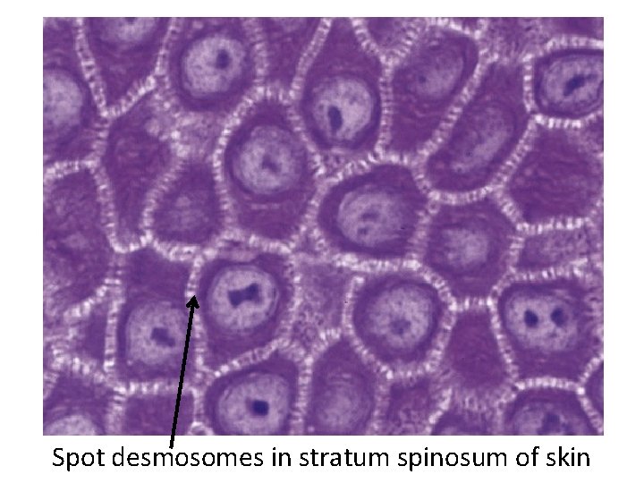 Spot desmosomes in stratum spinosum of skin 