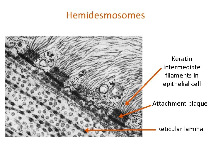 Hemidesmosomes Keratin intermediate filaments in epithelial cell Attachment plaque Reticular lamina 