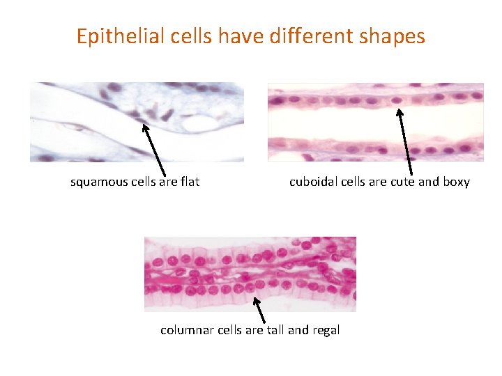 Epithelial cells have different shapes squamous cells are flat cuboidal cells are cute and