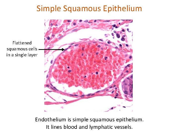 Simple Squamous Epithelium Flattened squamous cells in a single layer Endothelium is simple squamous