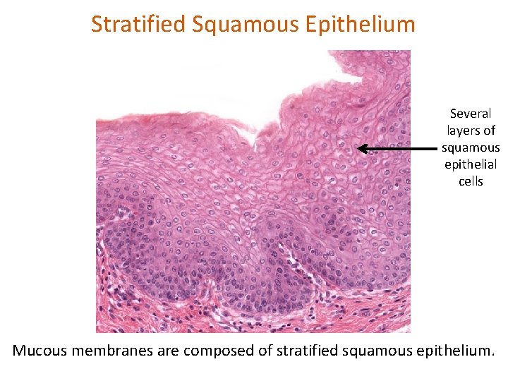 Stratified Squamous Epithelium Several layers of squamous epithelial cells Mucous membranes are composed of