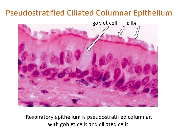 Pseudostratified Ciliated Columnar Epithelium goblet cell cilia Respiratory epithelium is pseudostratified columnar, with goblet