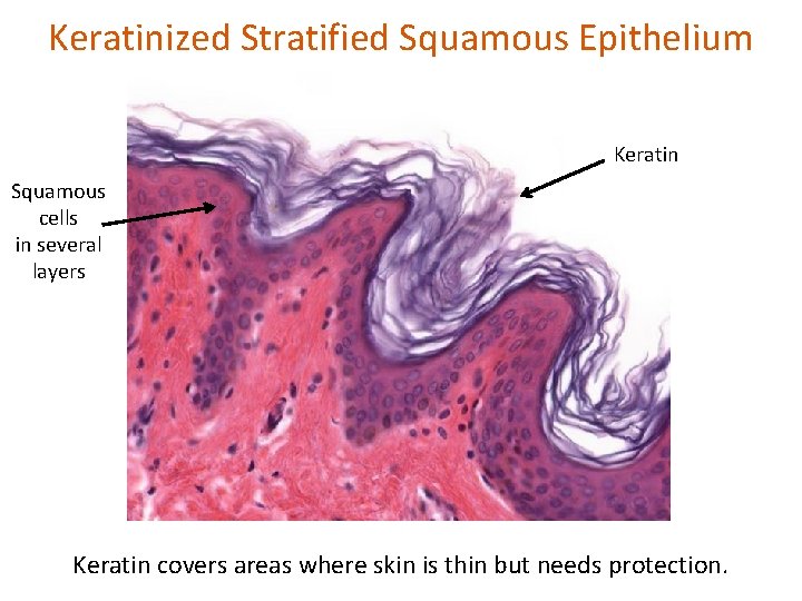 Keratinized Stratified Squamous Epithelium Keratin Squamous cells in several layers Keratin covers areas where