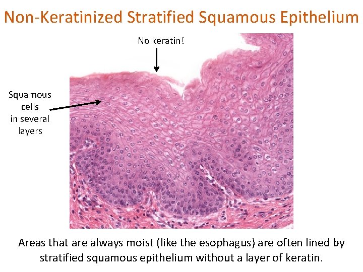 Non-Keratinized Stratified Squamous Epithelium No keratin! Squamous cells in several layers Areas that are