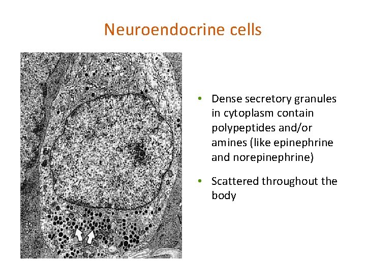 Neuroendocrine cells • Dense secretory granules in cytoplasm contain polypeptides and/or amines (like epinephrine