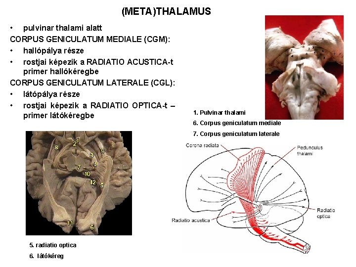 (META)THALAMUS • pulvinar thalami alatt CORPUS GENICULATUM MEDIALE (CGM): • hallópálya része • rostjai