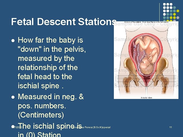 Fetal Descent Stations l l l How far the baby is "down" in the