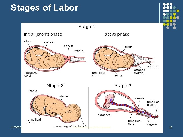 Stages of Labor 1/17/2022 Anuradha Perera (B. Sc. N)special 23 