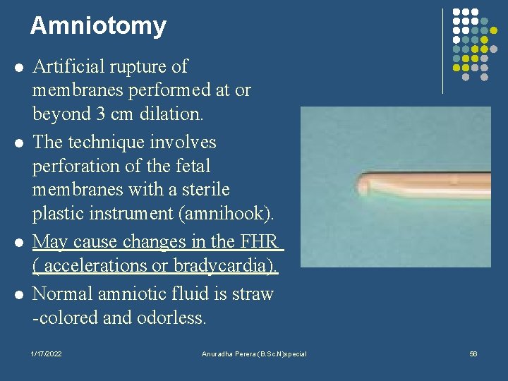 Amniotomy l l Artificial rupture of membranes performed at or beyond 3 cm dilation.