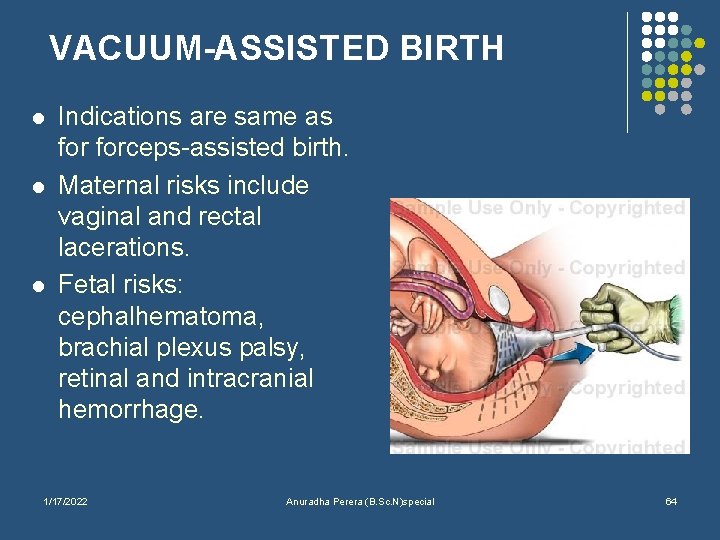 VACUUM-ASSISTED BIRTH l l l Indications are same as forceps-assisted birth. Maternal risks include
