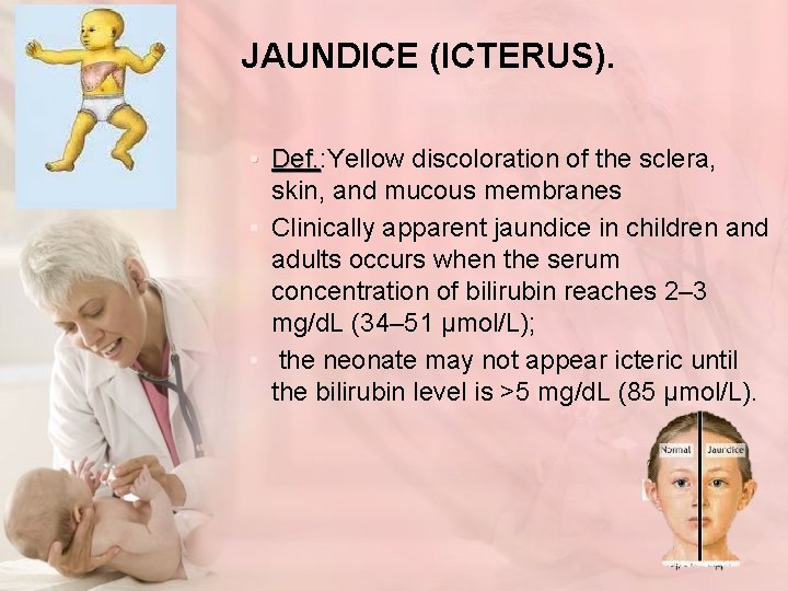JAUNDICE (ICTERUS). • Def. : Yellow discoloration of the sclera, Def. skin, and mucous