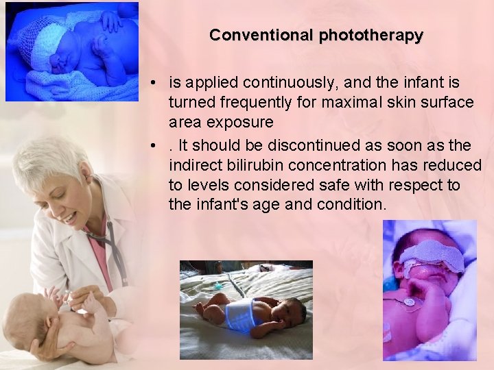 Conventional phototherapy • is applied continuously, and the infant is turned frequently for maximal