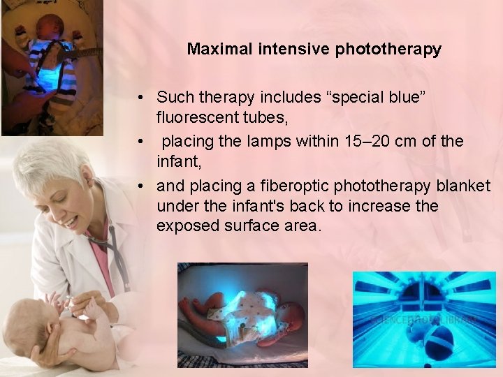 Maximal intensive phototherapy • Such therapy includes “special blue” fluorescent tubes, • placing the