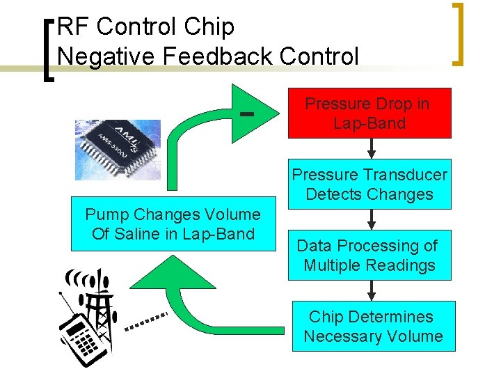 RF Control Chip Negative Feedback Control - Pressure Drop in Lap-Band Pressure Transducer Detects