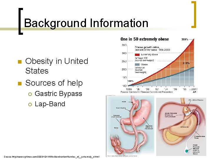 Background Information n n Obesity in United States Sources of help ¡ ¡ Gastric