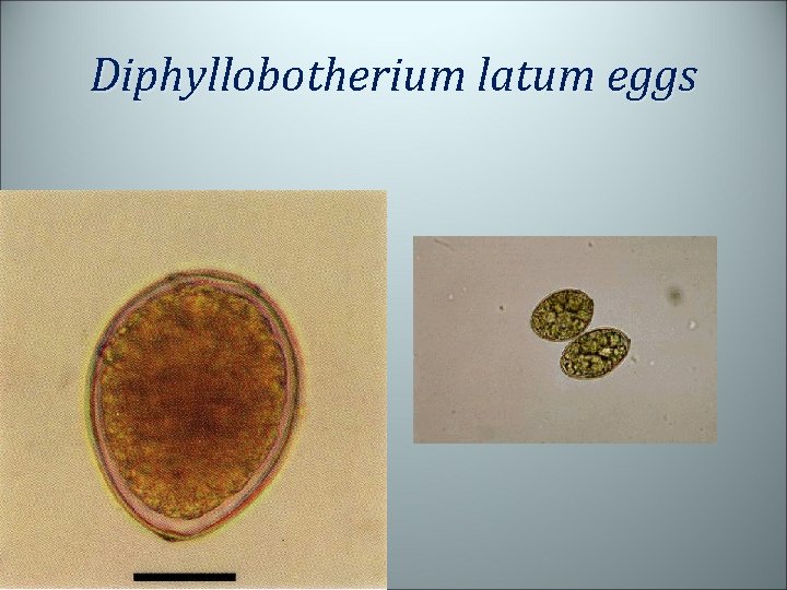 Diphyllobotherium latum eggs 