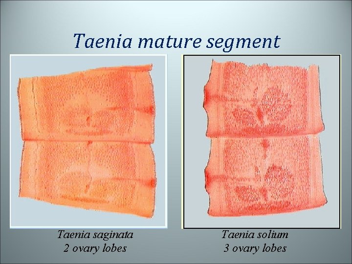 Taenia mature segment Taenia saginata 2 ovary lobes Taenia solium 3 ovary lobes 