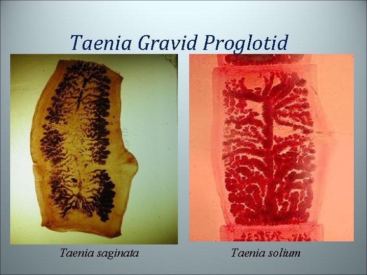 Taenia Gravid Proglotid Taenia saginata Taenia solium 