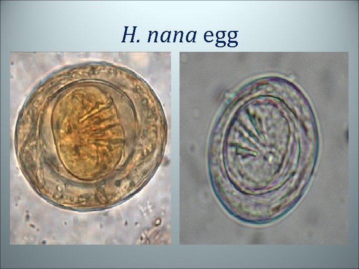 H. nana egg 