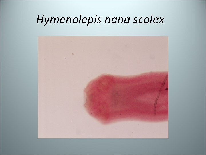 Hymenolepis nana scolex 
