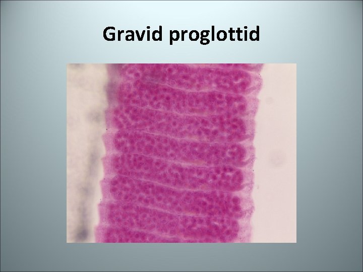 Gravid proglottid 