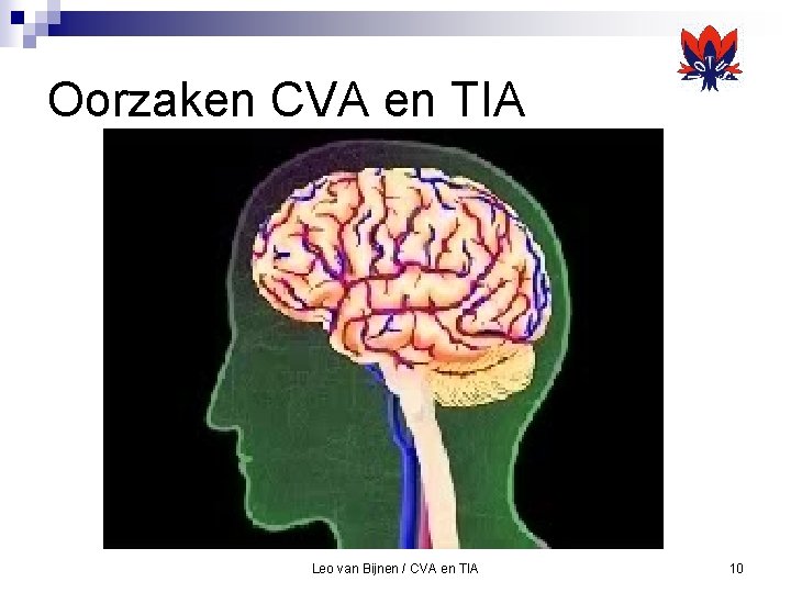 Oorzaken CVA en TIA Leo van Bijnen / CVA en TIA 10 