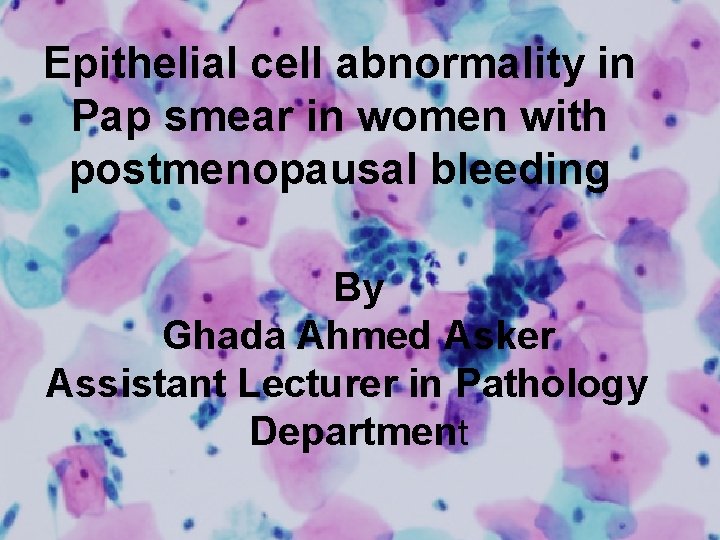 Epithelial cell abnormality in Pap smear in women with postmenopausal bleeding By Ghada Ahmed