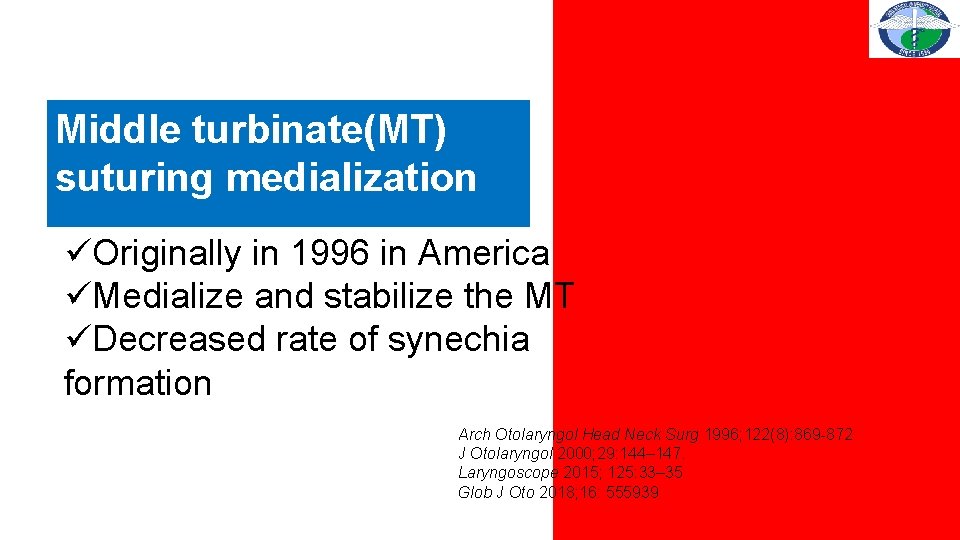 Middle turbinate(MT) suturing medialization üOriginally in 1996 in America üMedialize and stabilize the MT