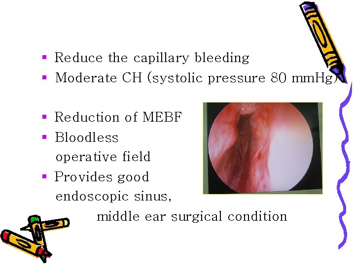 § Reduce the capillary bleeding § Moderate CH (systolic pressure 80 mm. Hg) §