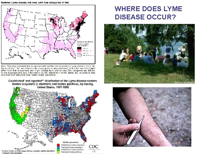 WHERE DOES LYME DISEASE OCCUR? 