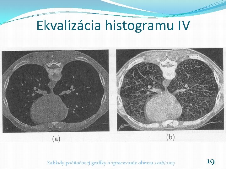 Ekvalizácia histogramu IV Základy počítačovej grafiky a spracovanie obrazu 2016/2017 19 