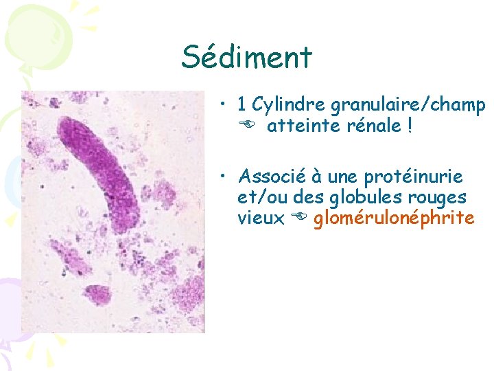 Sédiment • 1 Cylindre granulaire/champ atteinte rénale ! • Associé à une protéinurie et/ou
