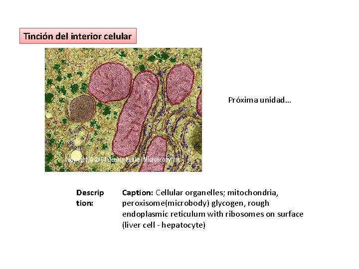 Tinción del interior celular Próxima unidad… Descrip tion: Caption: Cellular organelles; mitochondria, peroxisome(microbody) glycogen,