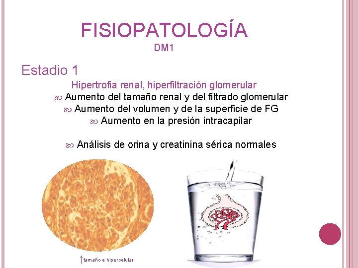 FISIOPATOLOGÍA DM 1 Estadio 1 Hipertrofia renal, hiperfiltración glomerular Aumento del tamaño renal y