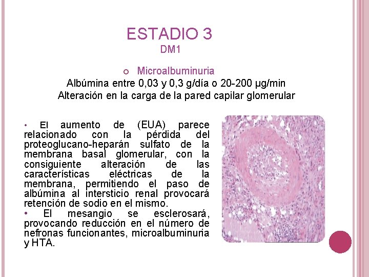 ESTADIO 3 DM 1 Microalbuminuria Albúmina entre 0, 03 y 0, 3 g/día o