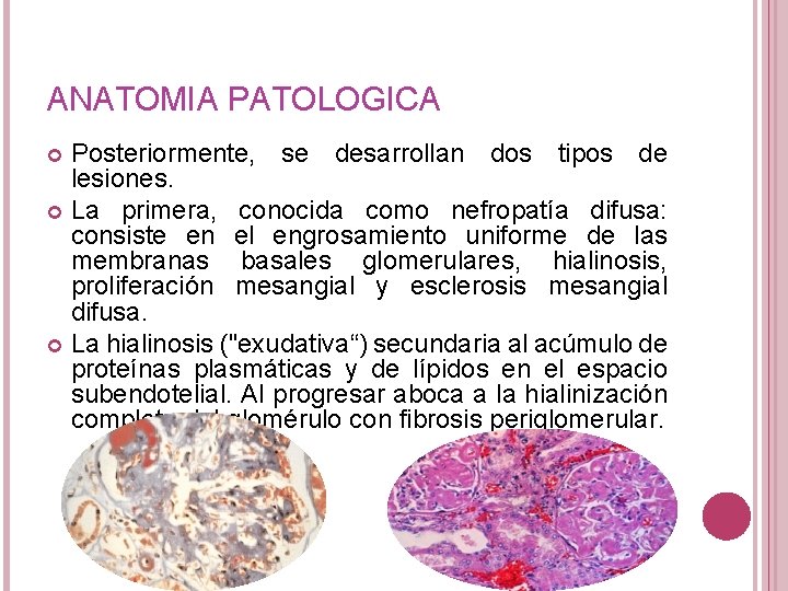 ANATOMIA PATOLOGICA Posteriormente, se desarrollan dos tipos de lesiones. La primera, conocida como nefropatía