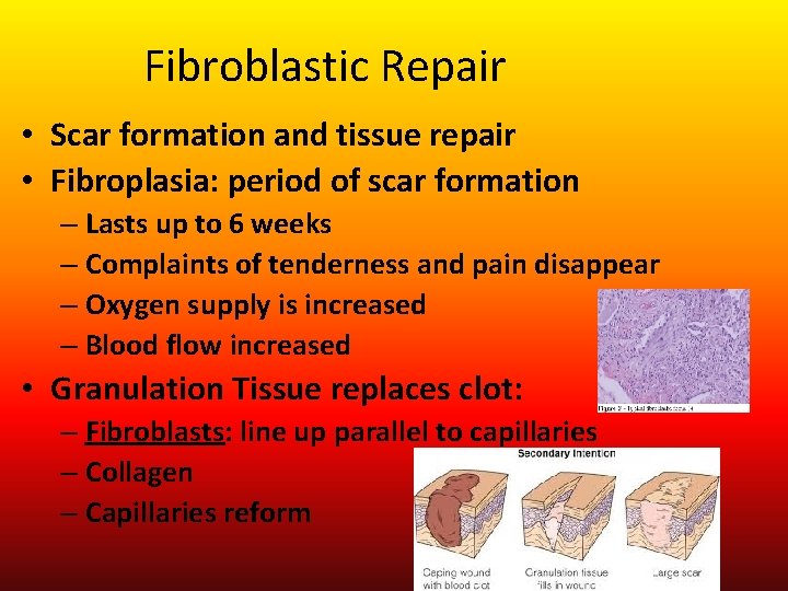 Fibroblastic Repair • Scar formation and tissue repair • Fibroplasia: period of scar formation