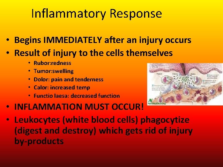 Inflammatory Response • Begins IMMEDIATELY after an injury occurs • Result of injury to