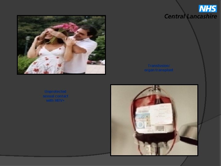 Transfusion/ organ transplant Unprotected sexual contact with HBV+ 