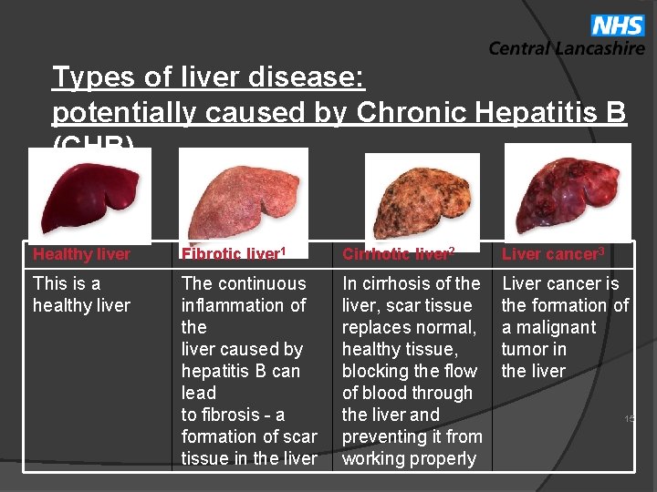 Types of liver disease: potentially caused by Chronic Hepatitis B (CHB) Healthy liver Fibrotic