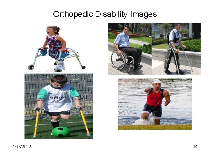 Orthopedic Disability Images 1/18/2022 34 