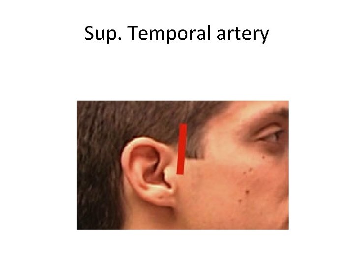 Sup. Temporal artery 